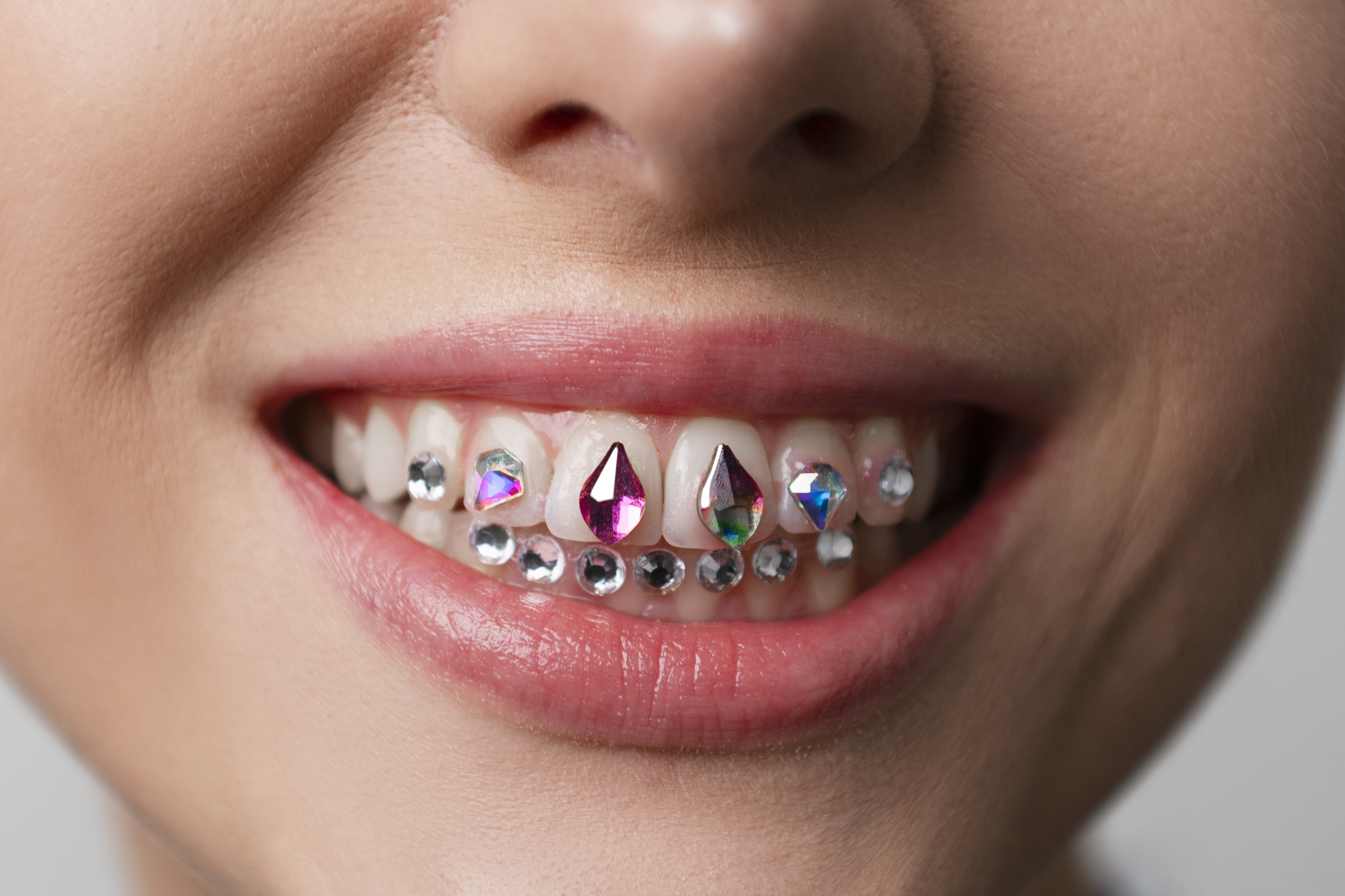 Tooth Gems