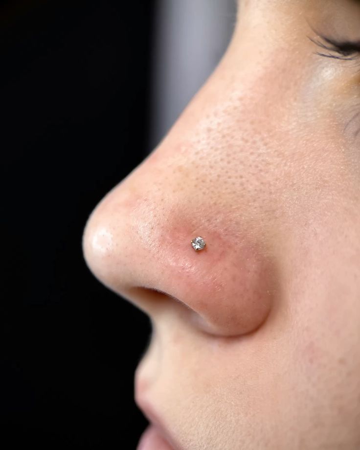 Nose